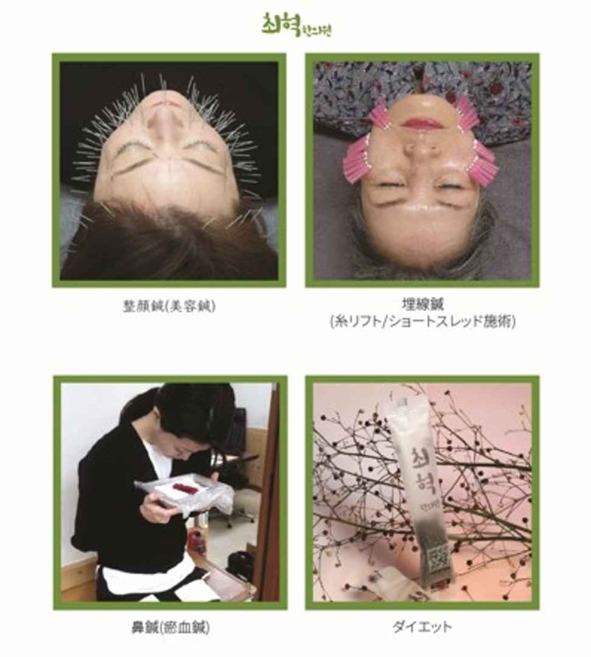 崔赫(チェヒョク)韓医院 (최혁한의원)