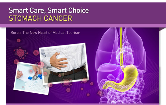Smart Care, Smart Choice : Stomach Cancer