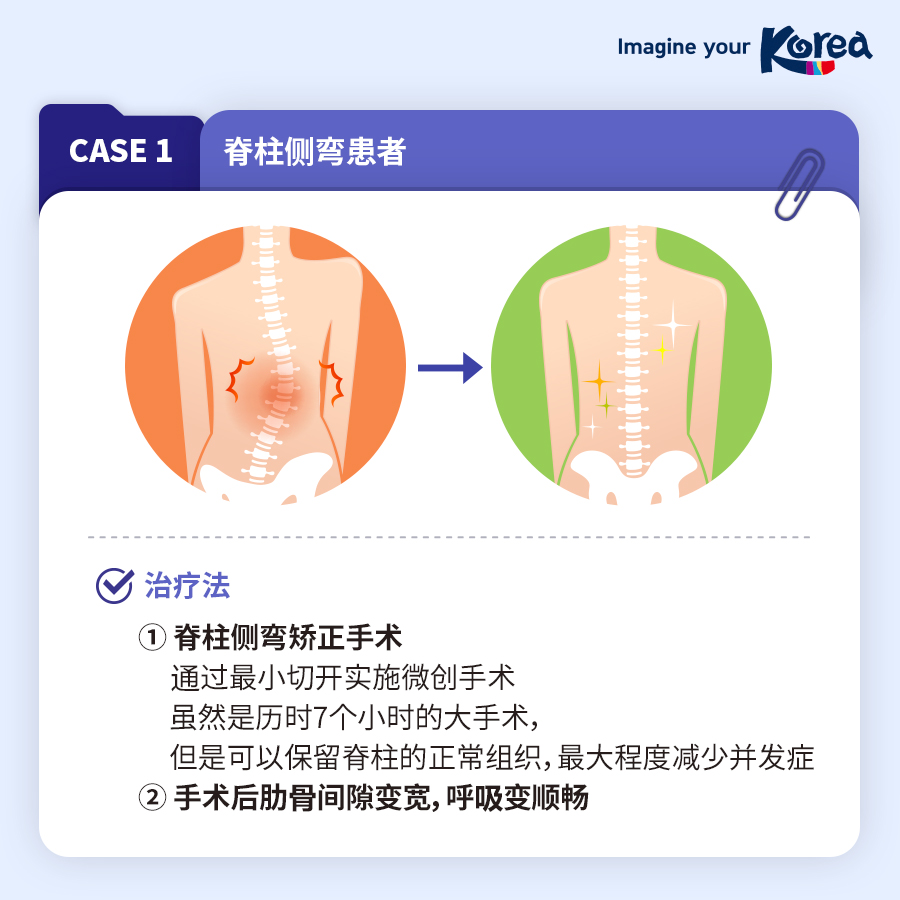 [卡新闻] 外国人患者的脊柱疾病治疗案例