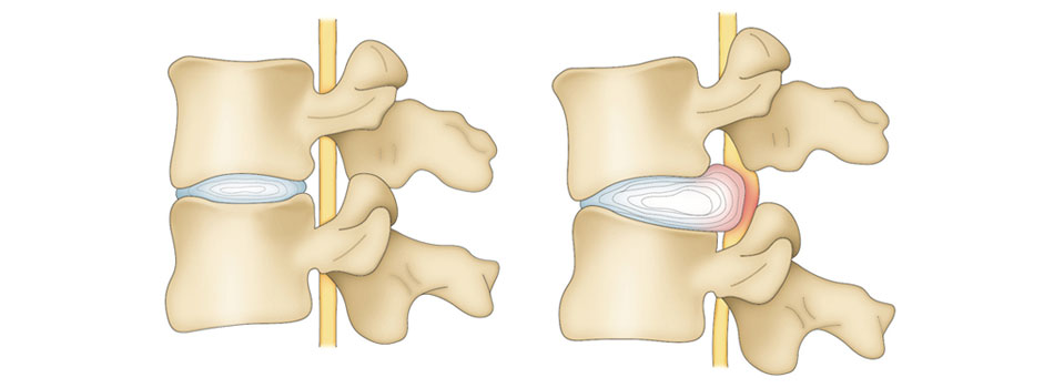 What to Know about Traditional Korean Medicine and Non-surgical Treatment 3