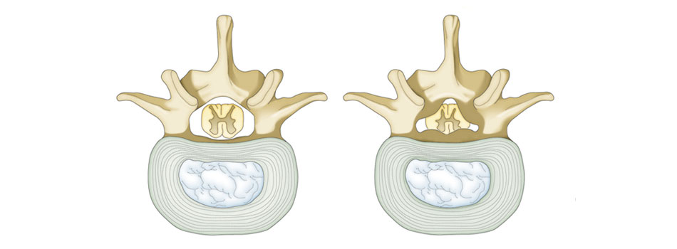 What to Know about Traditional Korean Medicine and Non-surgical Treatment 4