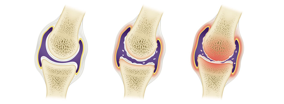 What to Know about Traditional Korean Medicine and Non-surgical Treatment 5