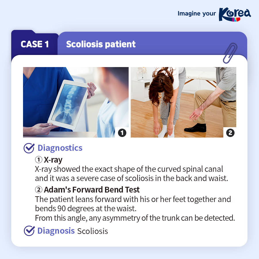 [Card News] Treatment case studies on Spinal Diseases in Korea for foreign patients