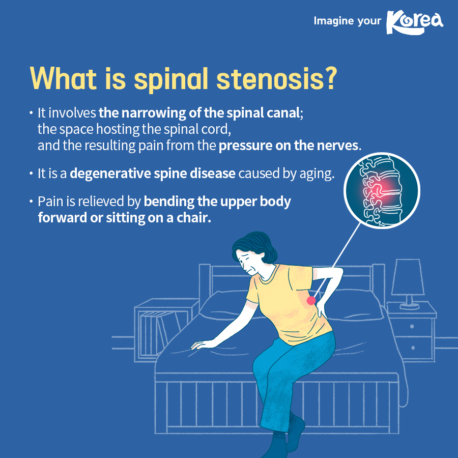 Case studies of spinal stenosis treatment in Korea for foreign patients