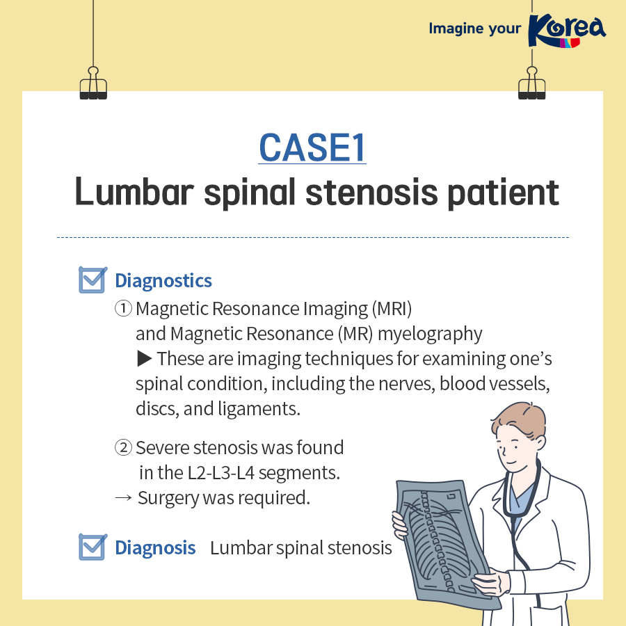 Case studies of spinal stenosis treatment in Korea for foreign patients