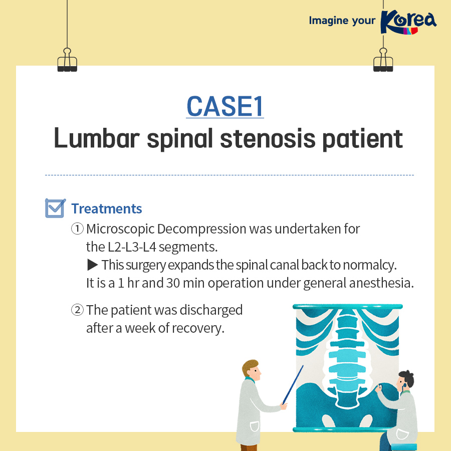 Case studies of spinal stenosis treatment in Korea for foreign patients