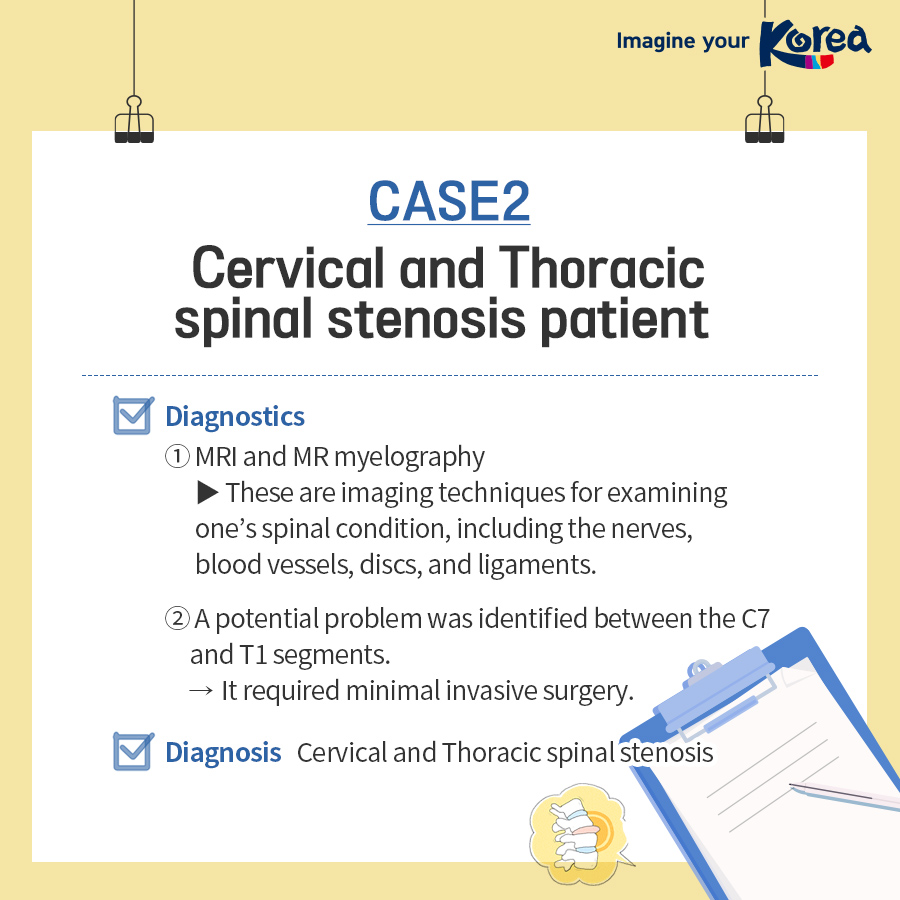 Case studies of spinal stenosis treatment in Korea for foreign patients