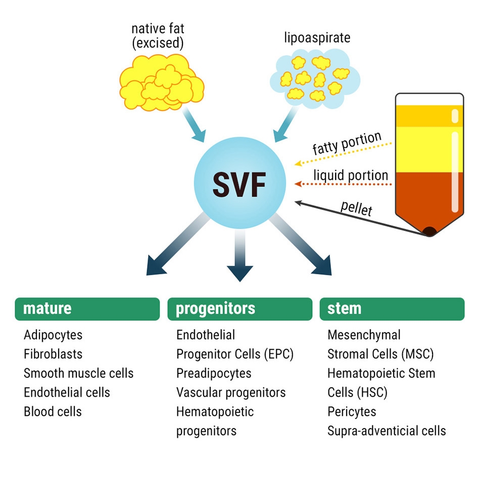 Components of SVF