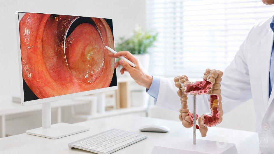 Medical Staff Reviewing a Colonoscopy Monitor