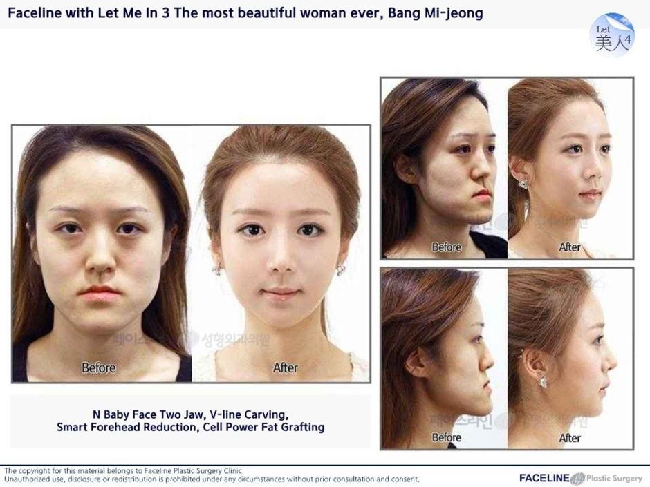 페이스라인 성형외과의원